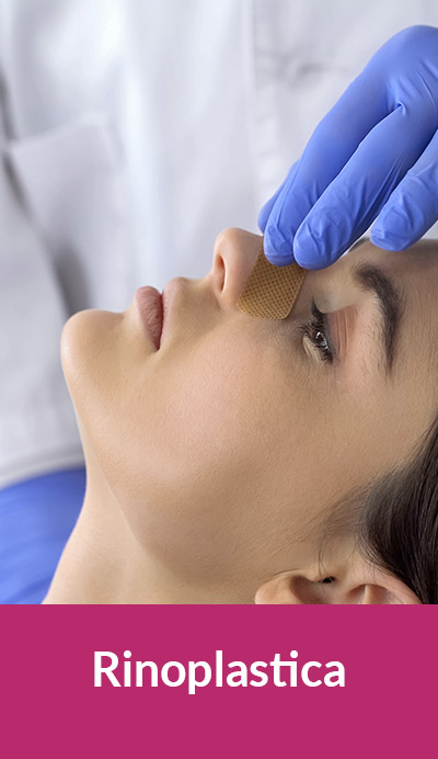 rinoplastica